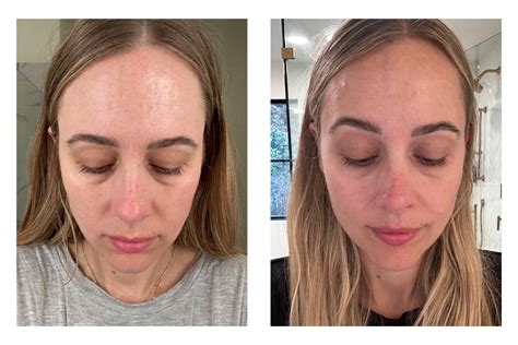 fmoviez.zo|zo medical skin health.